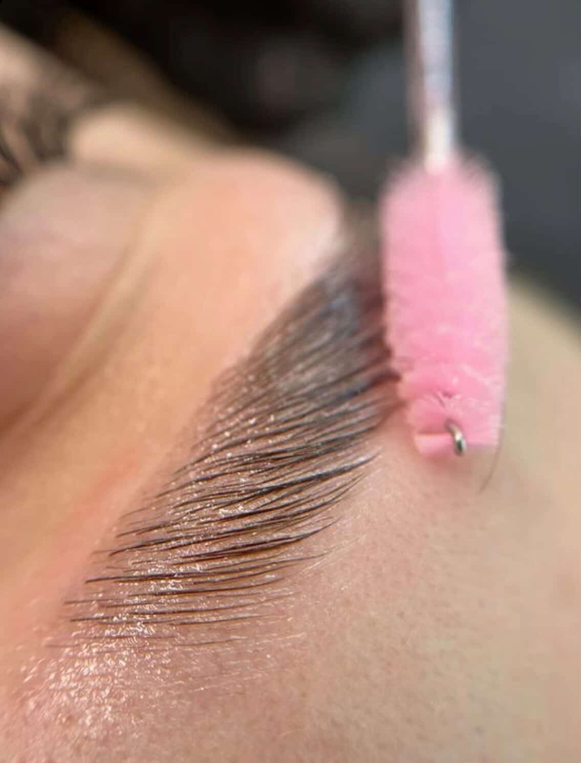 Browlifting